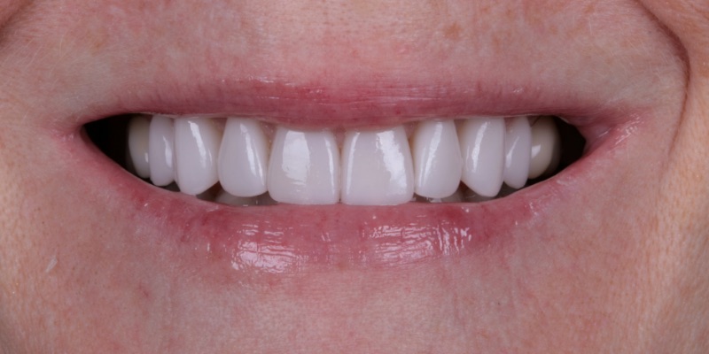 Kaminski one in Kelly Smile Design in Chicago