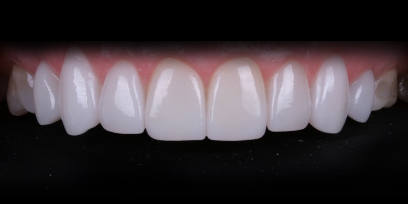 Smiles Kim three at Kelly Smile Design in Chicago, IL