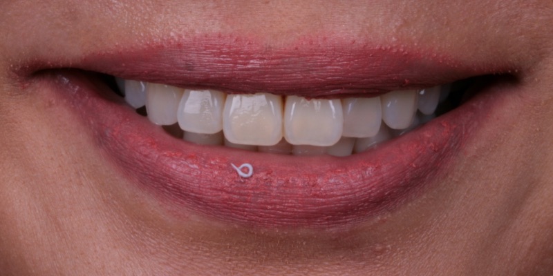 Jen Woman Two at Kelly Smile Design in Chicago, IL