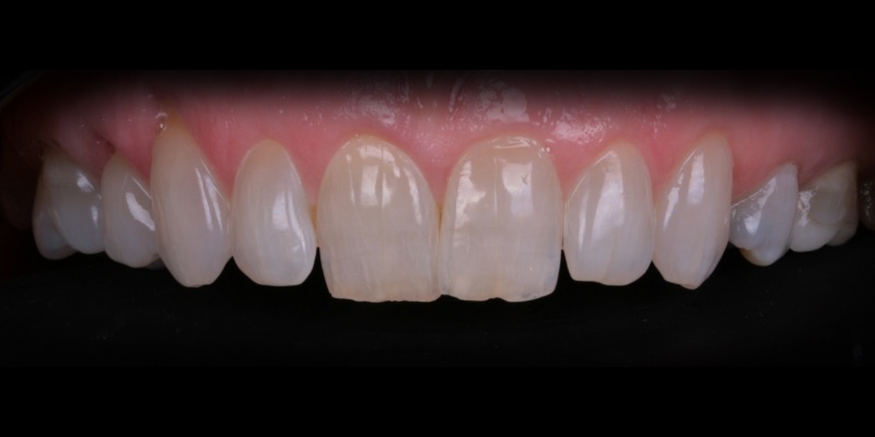 kim three at Kelly Smile Design in Chicago, IL