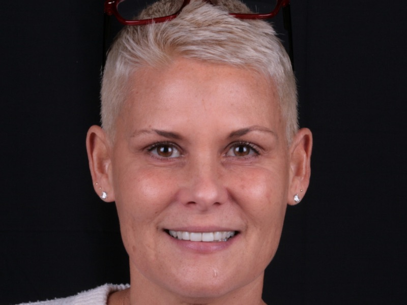 Denise one by Kelly Smile Design in Chicago