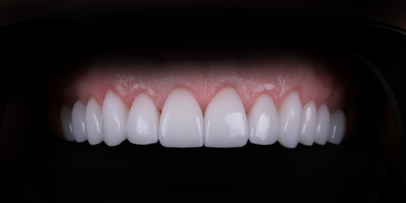 Nicole Three at Kelly Smile Design in Chicago